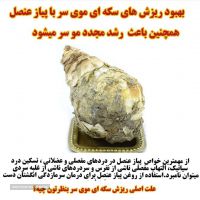 فروش روغن پیاز عنصل اصل در اصفهان