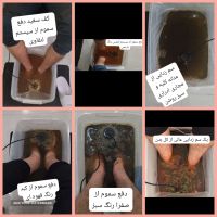 سم زدایی یون تراپی  درمان گرفتگی عروق در اصفهان 