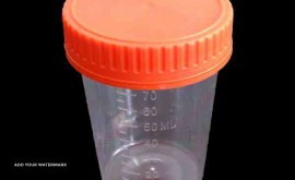 urine-bottle