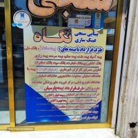 ساخت چشم مصنوعی در اصفهان