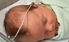انجام تست OAE در نوزادان خیابان بزرگمهر اصفهان
