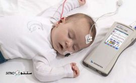 سنجش کم شنوایی با تست ABR در هشت بهشت اصفهان