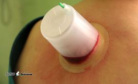 نرخ حجامت عام / اصفهان 