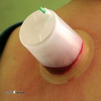 نرخ حجامت عام / اصفهان 