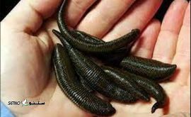شماره تلفن زالو درمانی / اصفهان / اتوبان خرازی