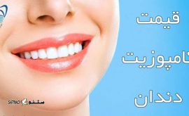 هزینه کامپوزیت دندان / اصفهان / خیابان توحید میانی