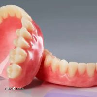 هزینه پروتز دندان / اصفهان / خیابان توحید