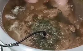 سم زدایی بدن با دستگاه جهت درمان کبد چرب / خانه اصفهان