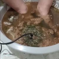 سم زدایی بدن با دستگاه جهت درمان کبد چرب / خانه اصفهان
