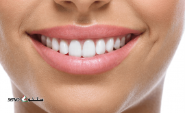 طح لبخند - لیفت لثه / دکتر ریاحی