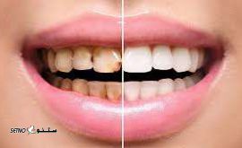 دندانپزشکی درکتر ریاحی در توحید اصفهان