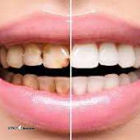 دندانپزشکی درکتر ریاحی در توحید اصفهان