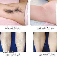 images (2)