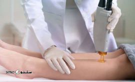 1603785086-توضیحات مهم لیزر موهای زائد