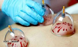 حجامت1405139_100