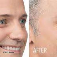 downloadبوتاکس