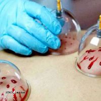 حجامت1405139_100